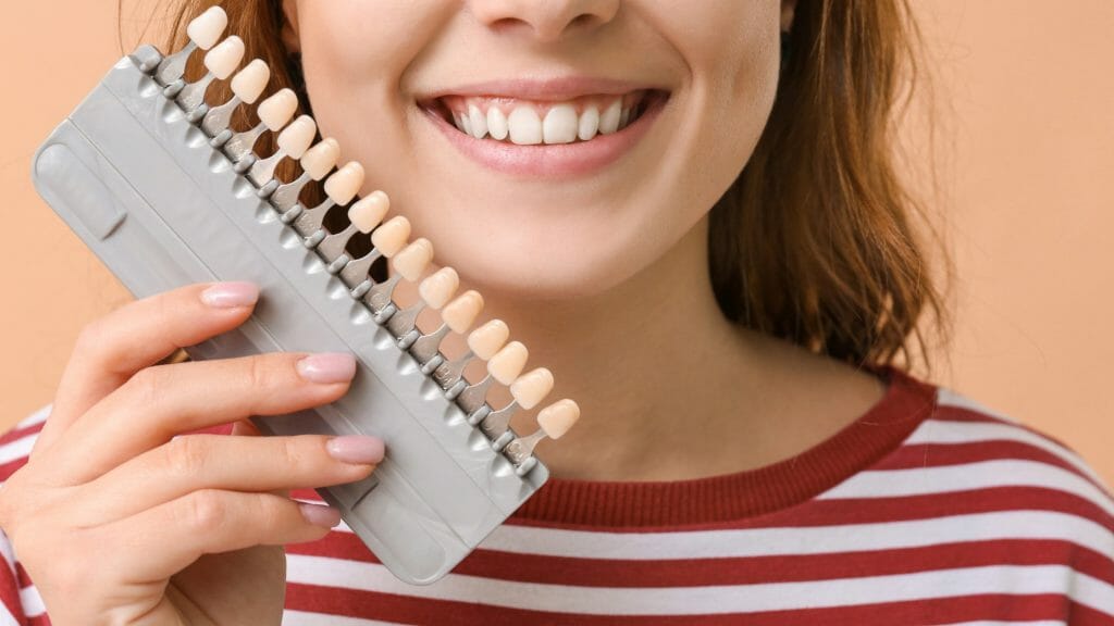 dental veneer bradford