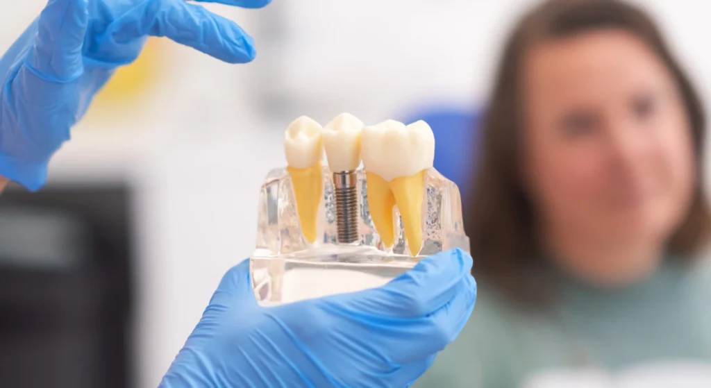 Which Is Better - An Implant Or A Crown